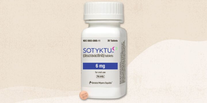 FDA Approves Sotyktu (Deucravacitinib) for Moderate-to-Severe Psoriasis