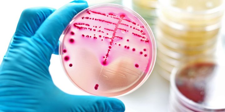 Novel Antibiotic Shown to Be an Effective UTI Treatment