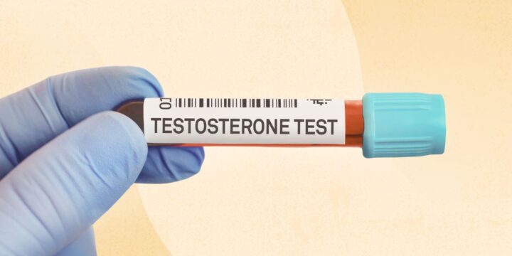 Testosterone May Aid Memory in Men With Uncontrolled Diabetes