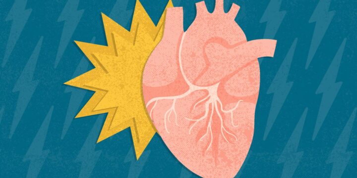 Even With Normal Blood Pressure, Stress Hormones Still Tied to Heart Attacks And Strokes